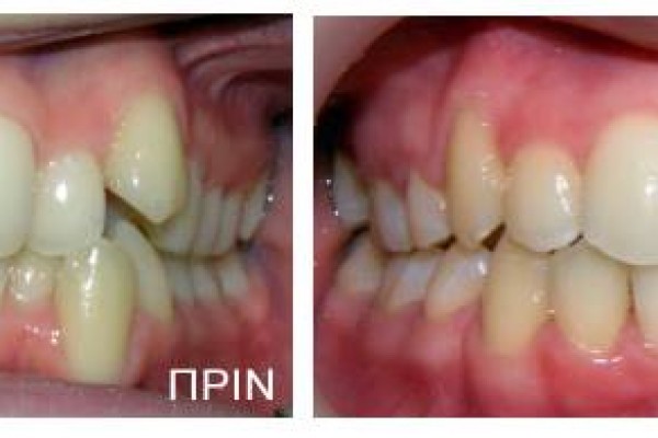 Ορθοδοντική