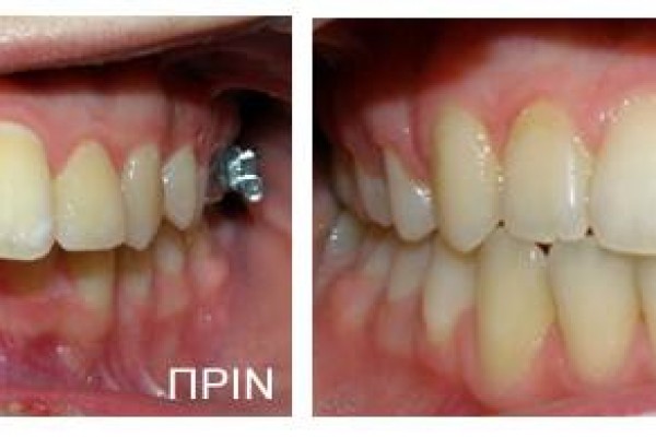 Ορθοδοντική